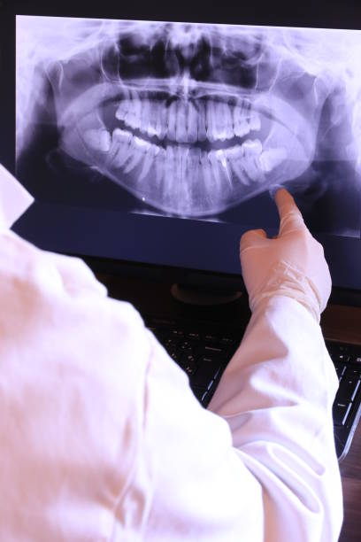 Best Emergency Broken Tooth Repair in Wellington, CO